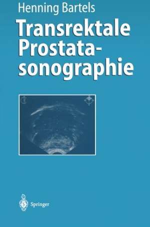 Transrektale Prostatasonographie de Henning Bartels