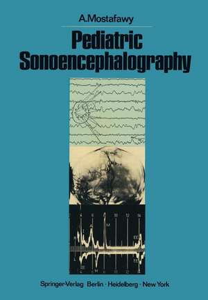 Pediatric Sonoencephalography: The Practical Use of Ultrasonic Echoes in the Diagnosis of Childhood Intracranial Disorders de J.B. Nagle