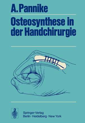 Osteosynthese in der Handchirurgie de A. Pannike