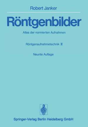 Röntgenbilder: Atlas der normierten Aufnahmen. Röntgenaufnahmetechnik · Teil II de Robert Janker