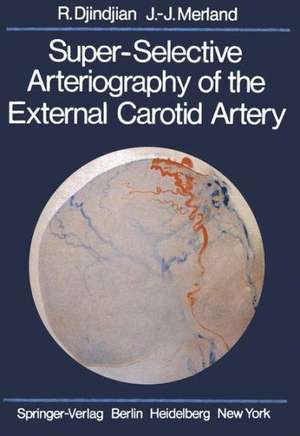 Super-Selective Arteriography of the External Carotid Artery de J. Theron