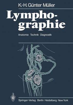 Lymphographie: Anatomie Technik Diagnostik de K. -H. G. Müller