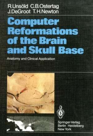 Computer Reformations of the Brain and Skull Base: Anatomy and Clinical Application de R. Unsöld