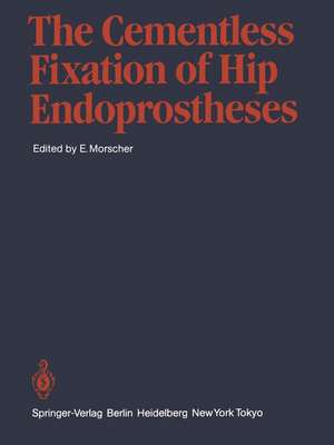 The Cementless Fixation of Hip Endoprostheses de E. Morscher