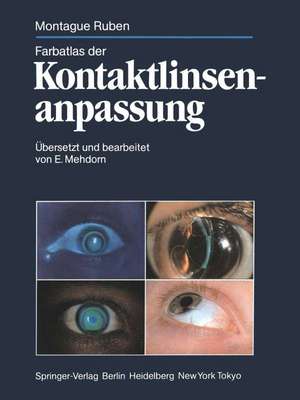 Farbatlas der Kontaktlinsenanpassung de Montague Ruben