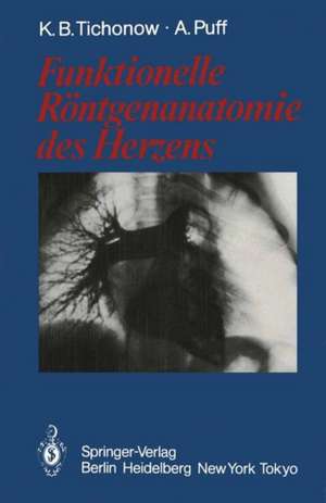 Funktionelle Röntgenanatomie des Herzens de Konstantin B. Tichonow