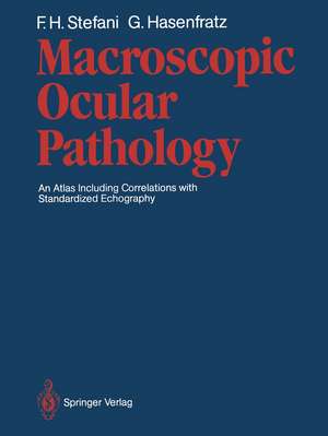 Macroscopic Ocular Pathology: An Atlas Including Correlations with Standardized Echography de Fritz H. Stefani