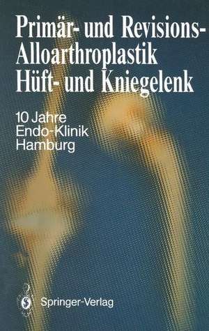 Primär- und Revisions-Alloarthroplastik Hüft- und Kniegelenk: 10 Jahre Endo-Klinik Hamburg de Endo-Klinik