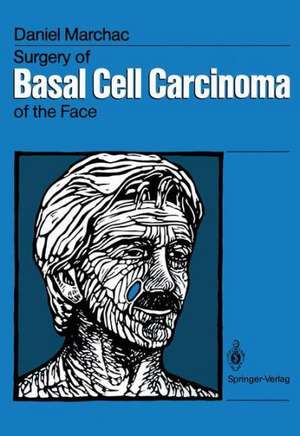 Surgery of Basal Cell Carcinoma of the Face de Claude Dufourmentel