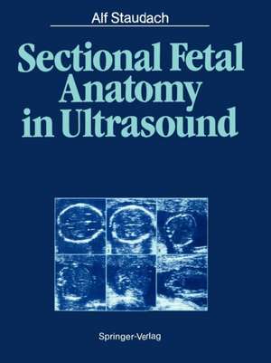 Sectional Fetal Anatomy in Ultrasound de Alf Staudach