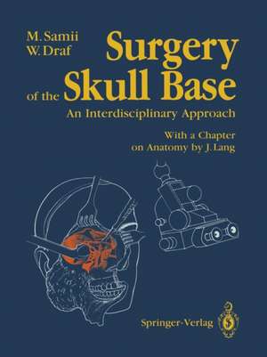 Surgery of the Skull Base: An Interdisciplinary Approach de Madjid Samii