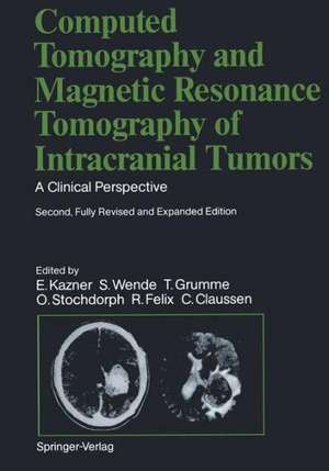 Computed Tomography and Magnetic Resonance Tomography of Intracranial Tumors: A Clinical Perspective de Terry C. Telger