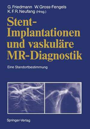 Stent-Implantationen und vaskuläre MR-Diagnostik: Eine Standortbestimmung de Gerd Friedmann