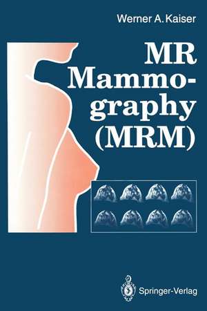 MR Mammography (MRM) de Werner A. Kaiser