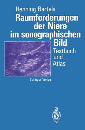 Raumforderungen der Niere im sonographischen Bild: Textbuch und Atlas de Henning Bartels