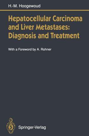 Hepatocellular Carcinoma and Liver Metastases: Diagnosis and Treatment de Henri-Marcel Hoogewoud