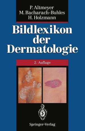 Bildlexikon der Dermatologie de N. Buhles