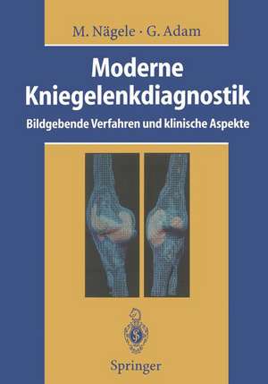 Moderne Kniegelenkdiagnostik: Bildgebende Verfahren und klinische Aspekte de Matthias Nägele