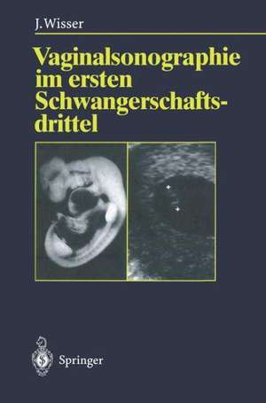 Vaginalsonographie im ersten Schwangerschaftsdrittel de Josef Wisser