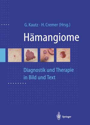 Hämangiome: Diagnostik und Therapie in Bild und Text de G. Kautz