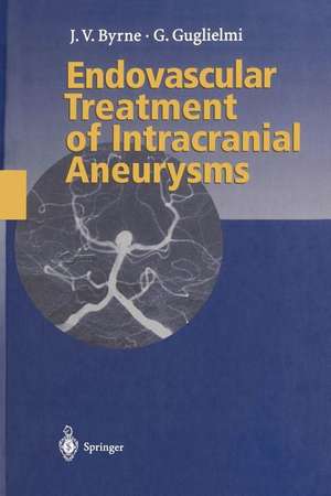 Endovascular Treatment of Intracranial Aneurysms de James Byrne