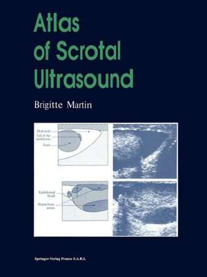 Atlas of Scrotal Ultrasound de Brigitte Martin