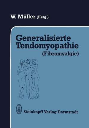 Generalisierte Tendomyopathie (Fibromyalgie): Vorträge anläßlich des Symposions über Generalisierte Tendomyopathie (Fibromyalgie) 27.–30. Juni 1990 in Bad Säckingen (D)/Rheinfelden (CH) de W. Müller