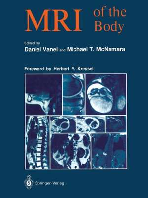 MRI of the Body de Daniel Vanel