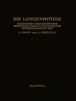 Die Lungenphthise: Ergebnisse Vergleichender Röntgenologisch-Anatomischer Untersuchungen de Siegfried Gräff