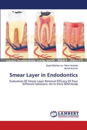 Smear Layer in Endodontics de Syed Mukhtar-un- Nisar Andrabi