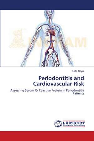 Periodontitis and Cardiovascular Risk de Lata Goyal