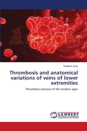 Thrombosis and anatomical variations of veins of lower extremities de Svetlana Jović