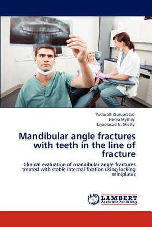 Mandibular angle fractures with teeth in the line of fracture de Yadavalli Guruprasad