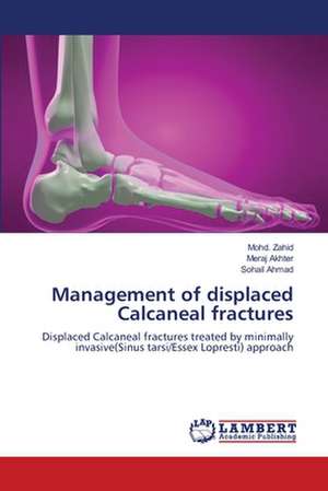 Management of displaced Calcaneal fractures de Mohd. Zahid