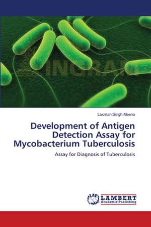 Development of Antigen Detection Assay for Mycobacterium Tuberculosis de Laxman Singh Meena