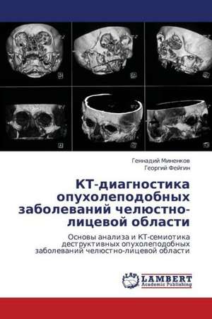 KT-diagnostika opukholepodobnykh zabolevaniy chelyustno-litsevoy oblasti de Minenkov Gennadiy