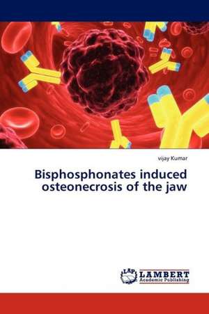 Bisphosphonates induced osteonecrosis of the jaw de Vijay Kumar