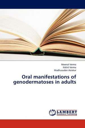 Oral manifestations of genodermatoses in adults de Verma Meenal