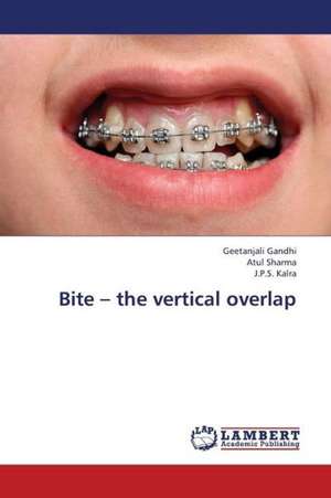 Bite - the vertical overlap de Gandhi Geetanjali