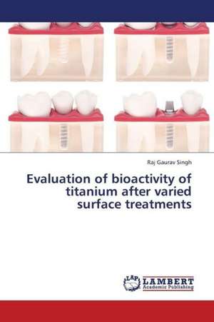 Evaluation of bioactivity of titanium after varied surface treatments de Singh Raj Gaurav