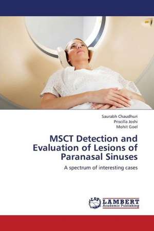 MSCT Detection and Evaluation of Lesions of Paranasal Sinuses de Chaudhuri Saurabh