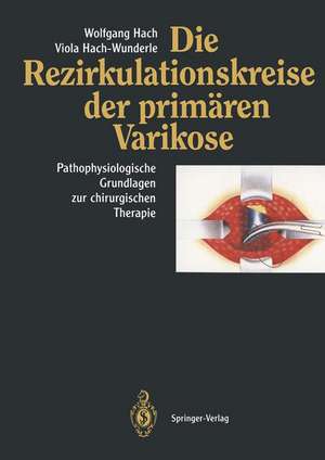 Die Rezirkulationskreise der primären Varikose: Pathophysiologische Grundlagen zur chirurgischen Therapie de Wolfgang Hach