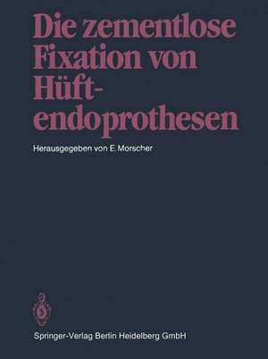 Die zementlose Fixation von Hüftendoprothesen de E. Morscher