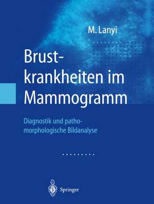 Brustkrankheiten im Mammogramm: Diagnostik und pathomorphologische Bildanalyse de Marton Lanyi