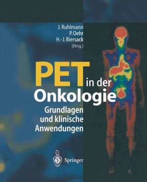 PET in der Onkologie: Grundlagen und klinische Anwendung de Jürgen Ruhlmann