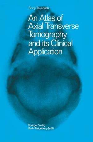 An Atlas of Axial Transverse Tomography and its Clinical Application de Shinji Takahashi