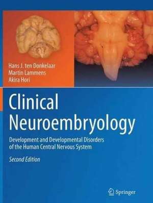 Clinical Neuroembryology: Development and Developmental Disorders of the Human Central Nervous System de Hans J. ten Donkelaar