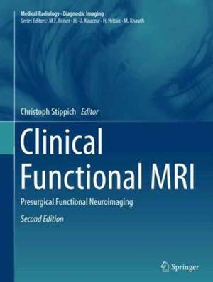 Clinical Functional MRI: Presurgical Functional Neuroimaging de Christoph Stippich