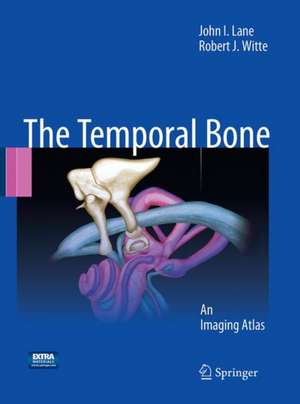 Temporal Bone: An Imaging Atlas de John I. Lane