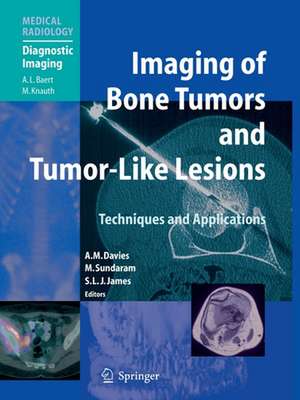 Imaging of Bone Tumors and Tumor-Like Lesions: Techniques and Applications de A. Mark Davies